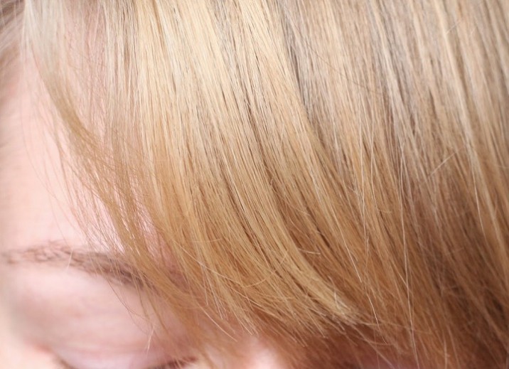 Mes solutions naturelles pour éviter de perdre ses cheveux